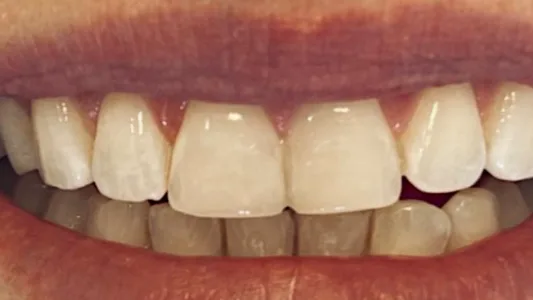 Case 01, after treatment