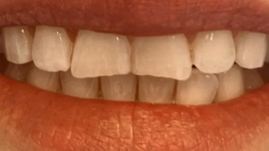 Case 01, before treatment