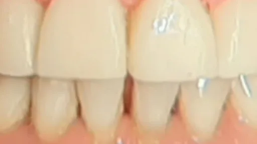 Case 02, after treatment