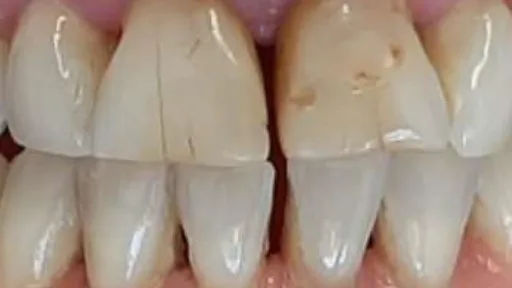 Case 02, before treatment