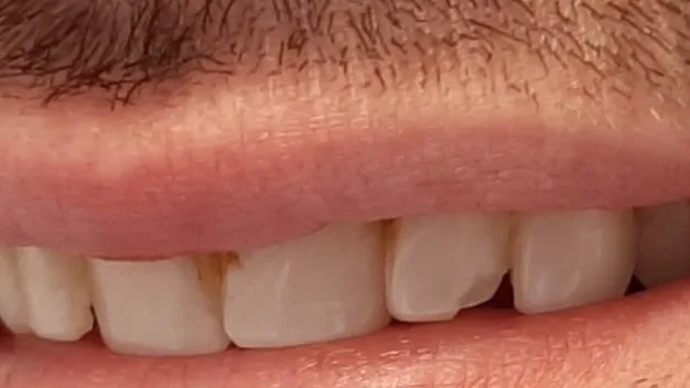 Case 03, before treatment