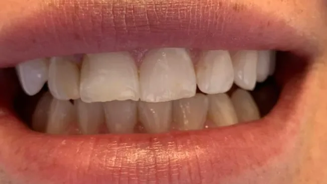 Case 04, before treatment