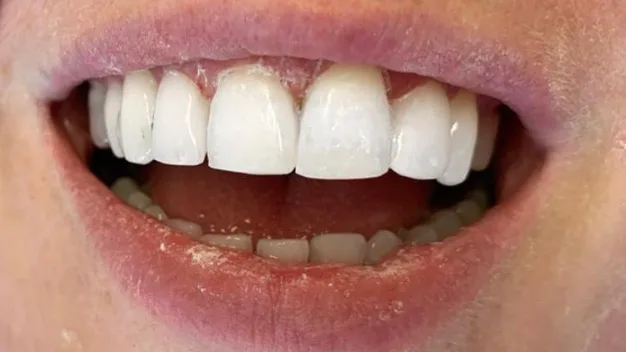 Case 05, after treatment