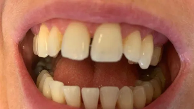 Case 05, before treatment