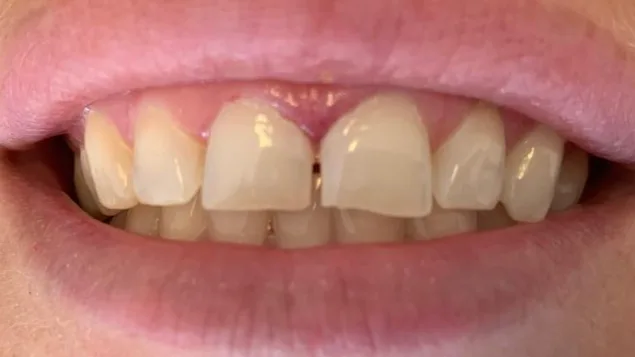 Case 06, before treatment