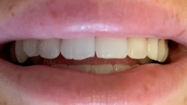 Case 07, before treatment