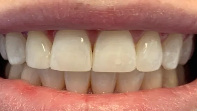 Case 08, after treatment