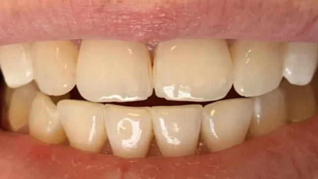 Case 08, before treatment