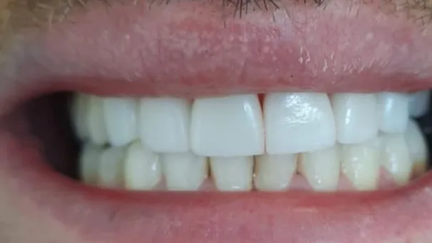 Case 09, after treatment