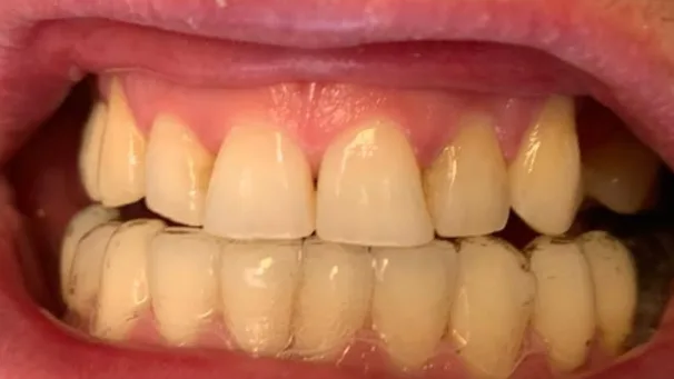 Case 09, before treatment