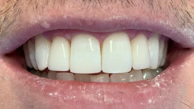 Case 10, after treatment