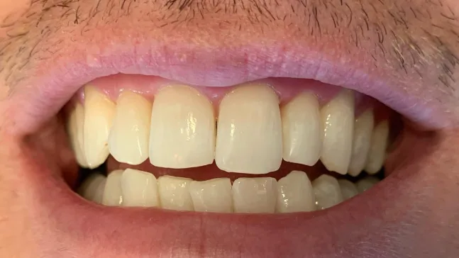 Case 10, before treatment