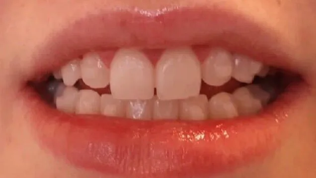 Case 11, before treatment