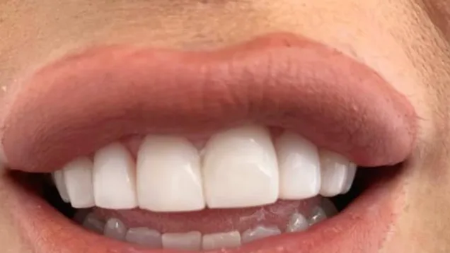 Case 12, after treatment