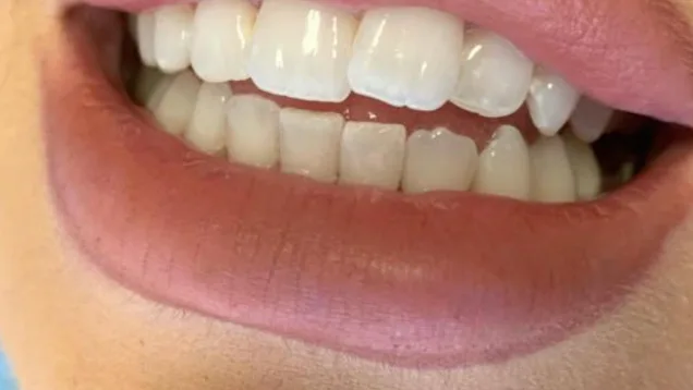 Case 12, before treatment